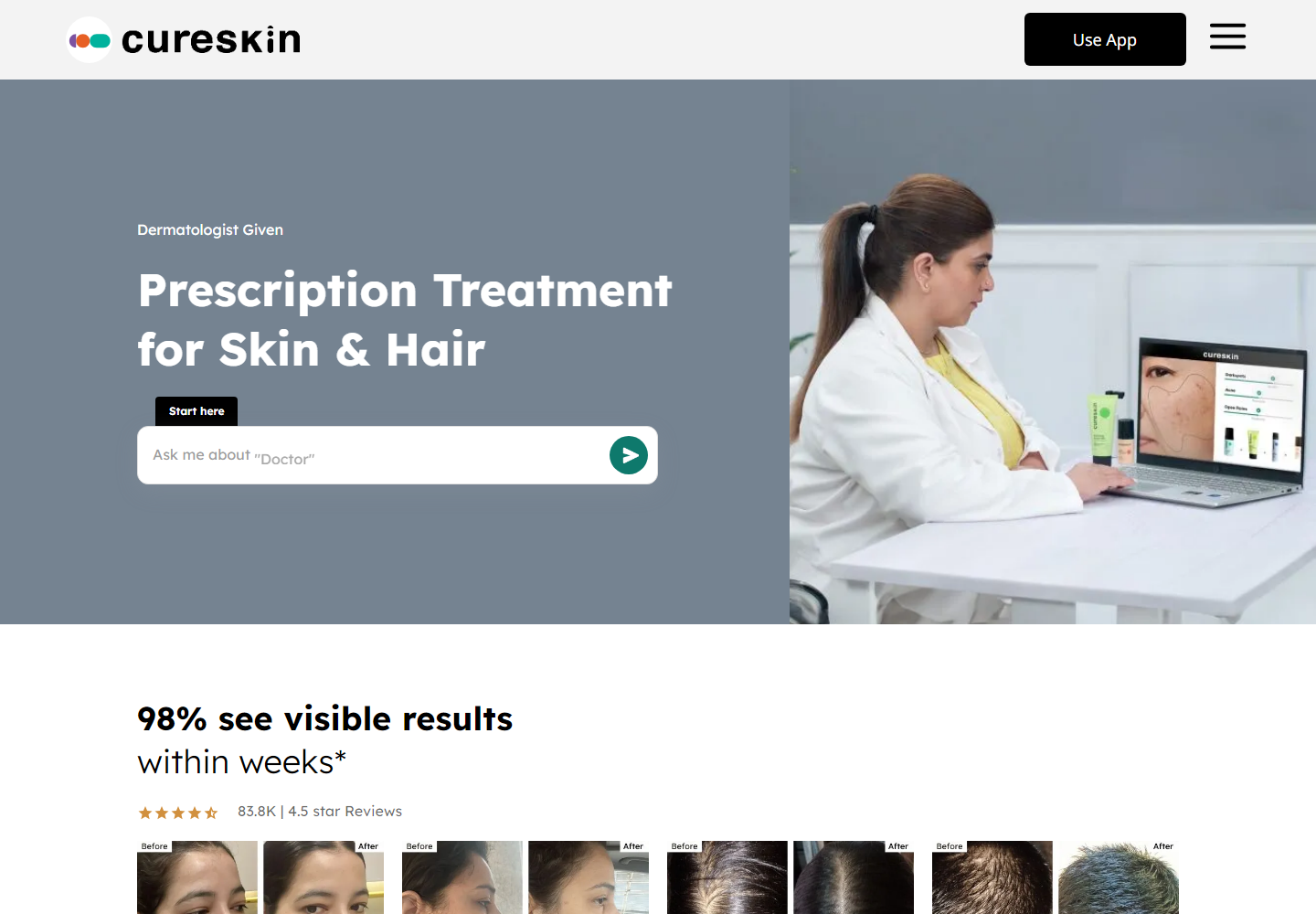 Cureskin homepage