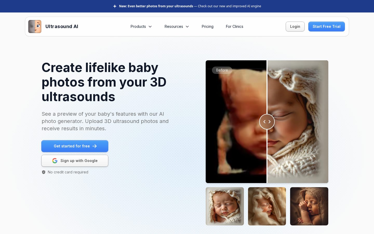 Ultrasound AI Homepage